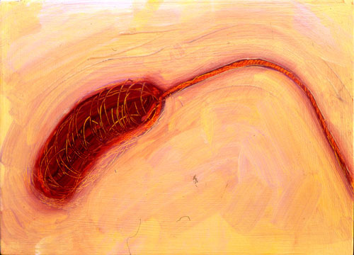 cholera