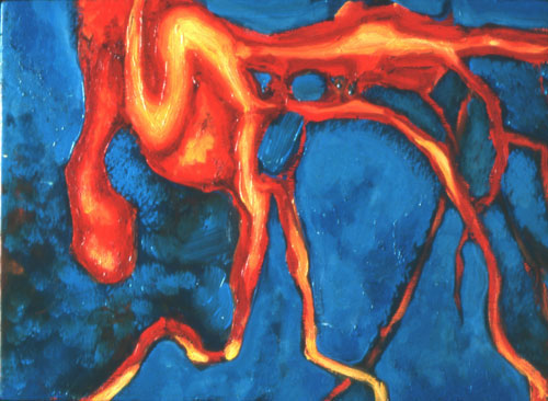 coronary