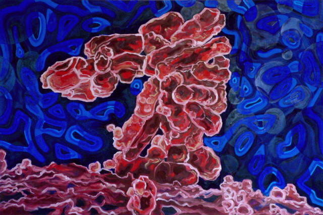 e-coli