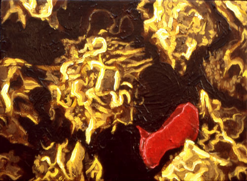 leukemia