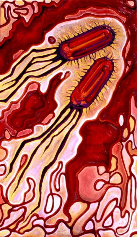 sepsis2