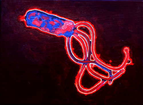 ulcer